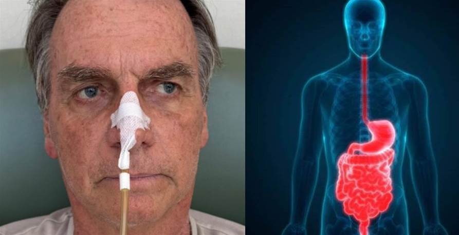 Bolsonaro na UTI: Saúde Frágil e Controvérsias Jurídicas