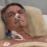 Jair Bolsonaro segue internado com pneumonia bacteriana bilateral, mas apresenta melhora em Brasília
