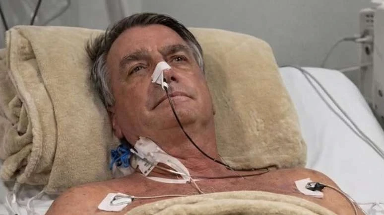 Jair Bolsonaro segue internado com pneumonia bacteriana bilateral, mas apresenta melhora em Brasília